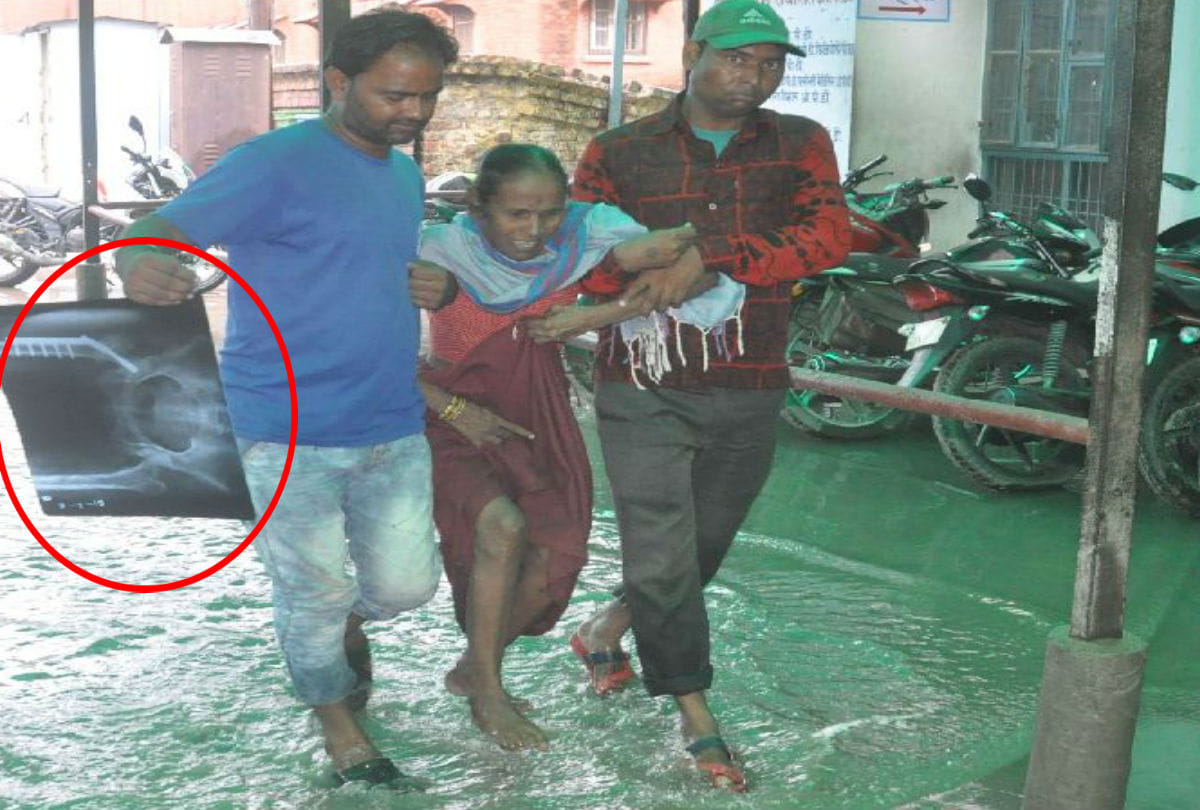 Delivery Patient on Stretcher No Operation In Sn Medical College Agra