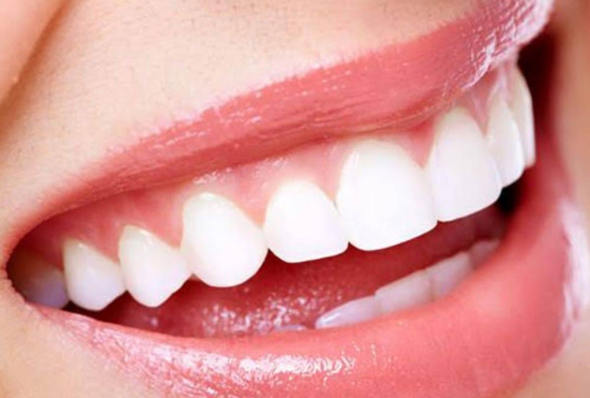tips for healthy teeth by dr. lakshya Yadav