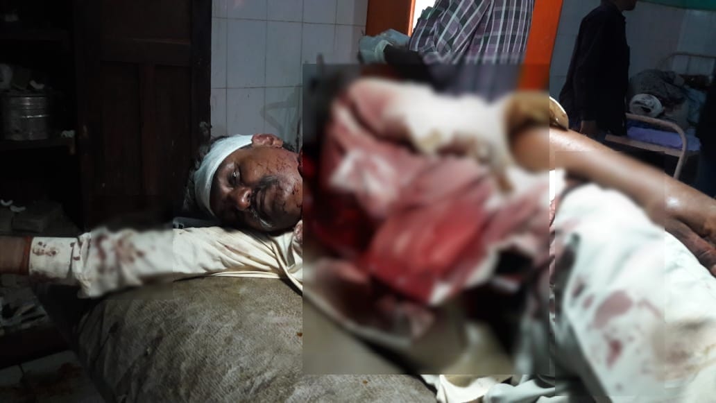 clash between two sides for land dispute many people died injured in ghorawal sonbhadra