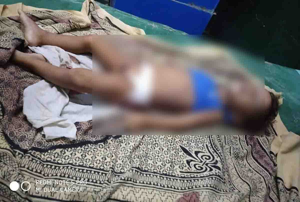 boy died due to fake doctor operated him