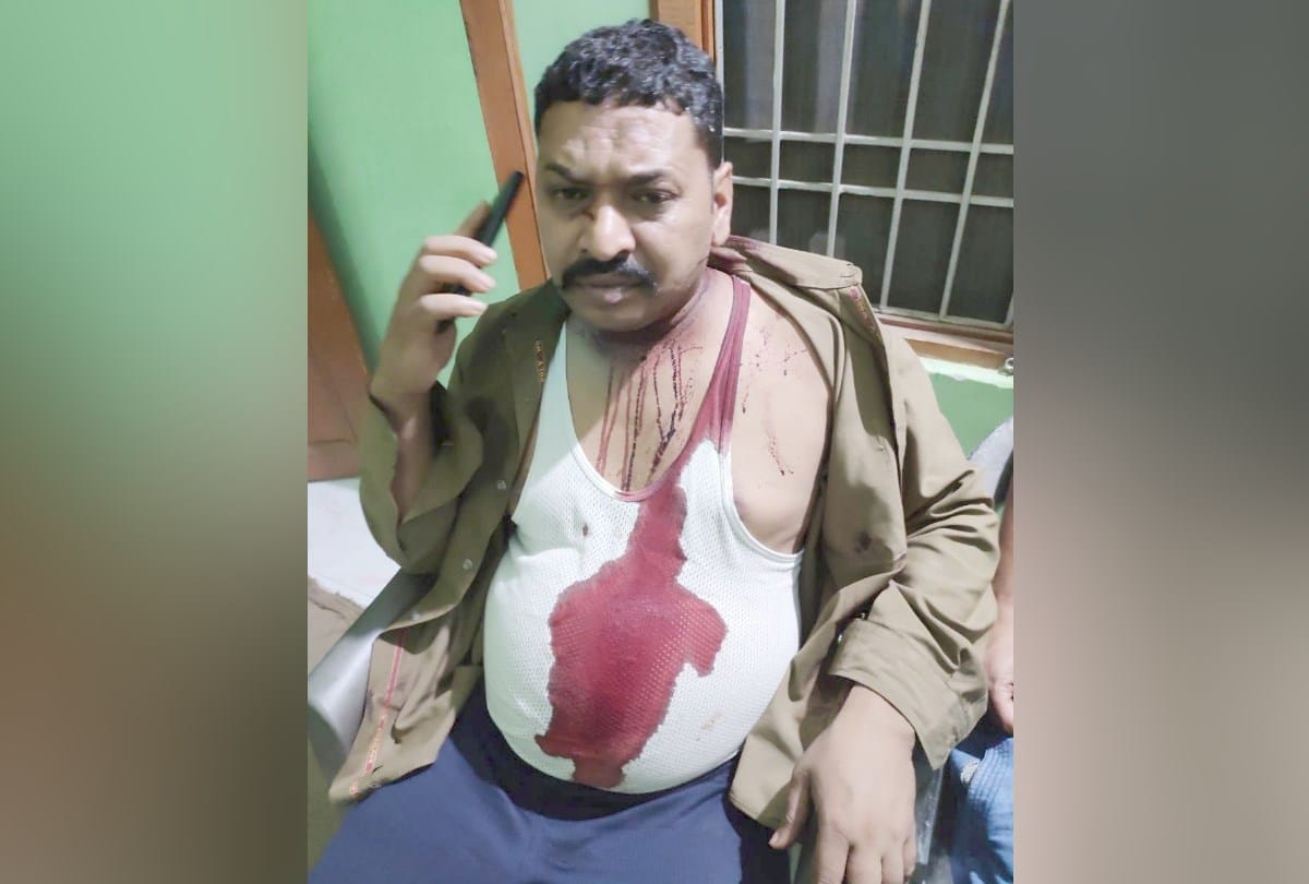HRTC bus conductor beaten by miscreant in Mandi himachal pradesh