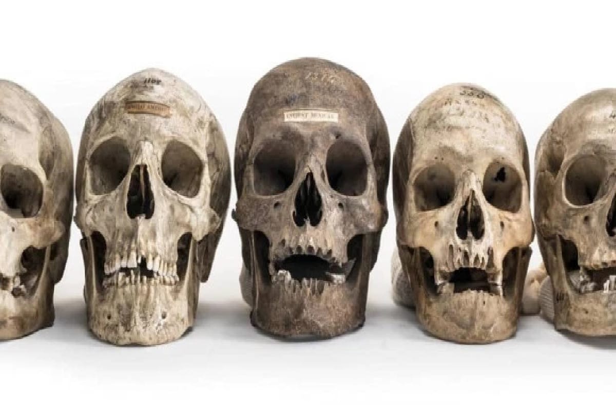 human remains for sell online instagram in uk