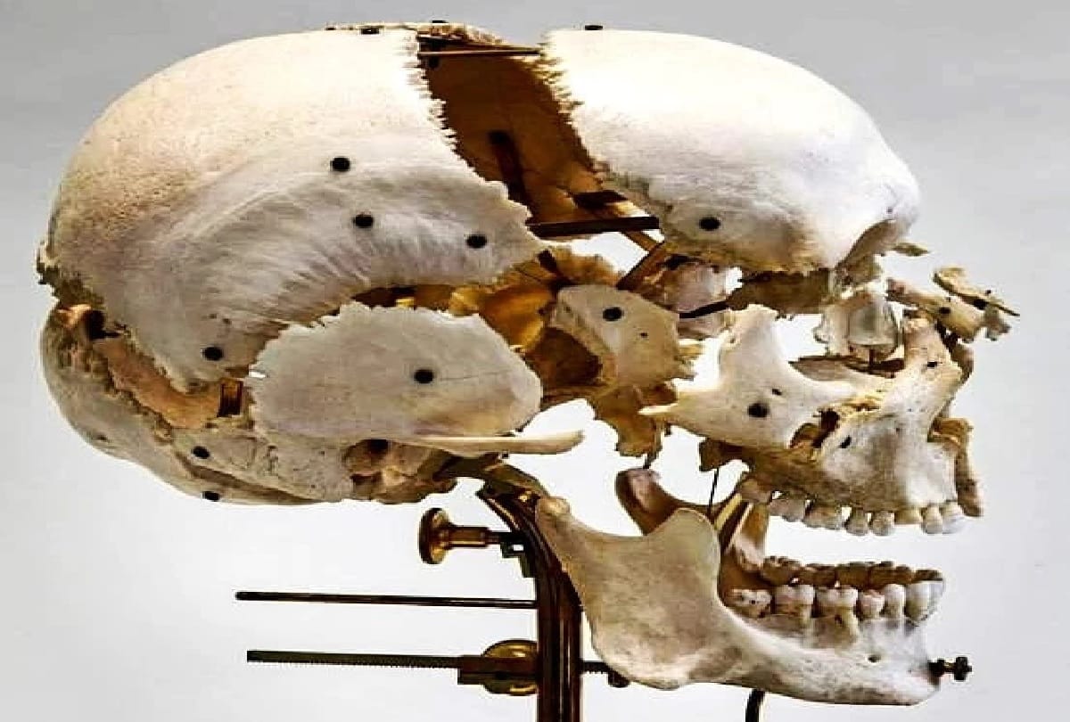 human remains for sell online instagram in uk