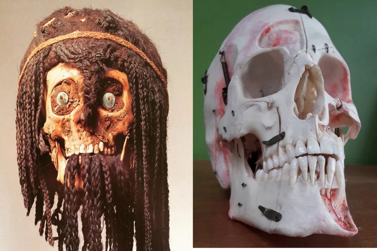 HUMAN skulls and other bones are being sold across the UK via Instagram
