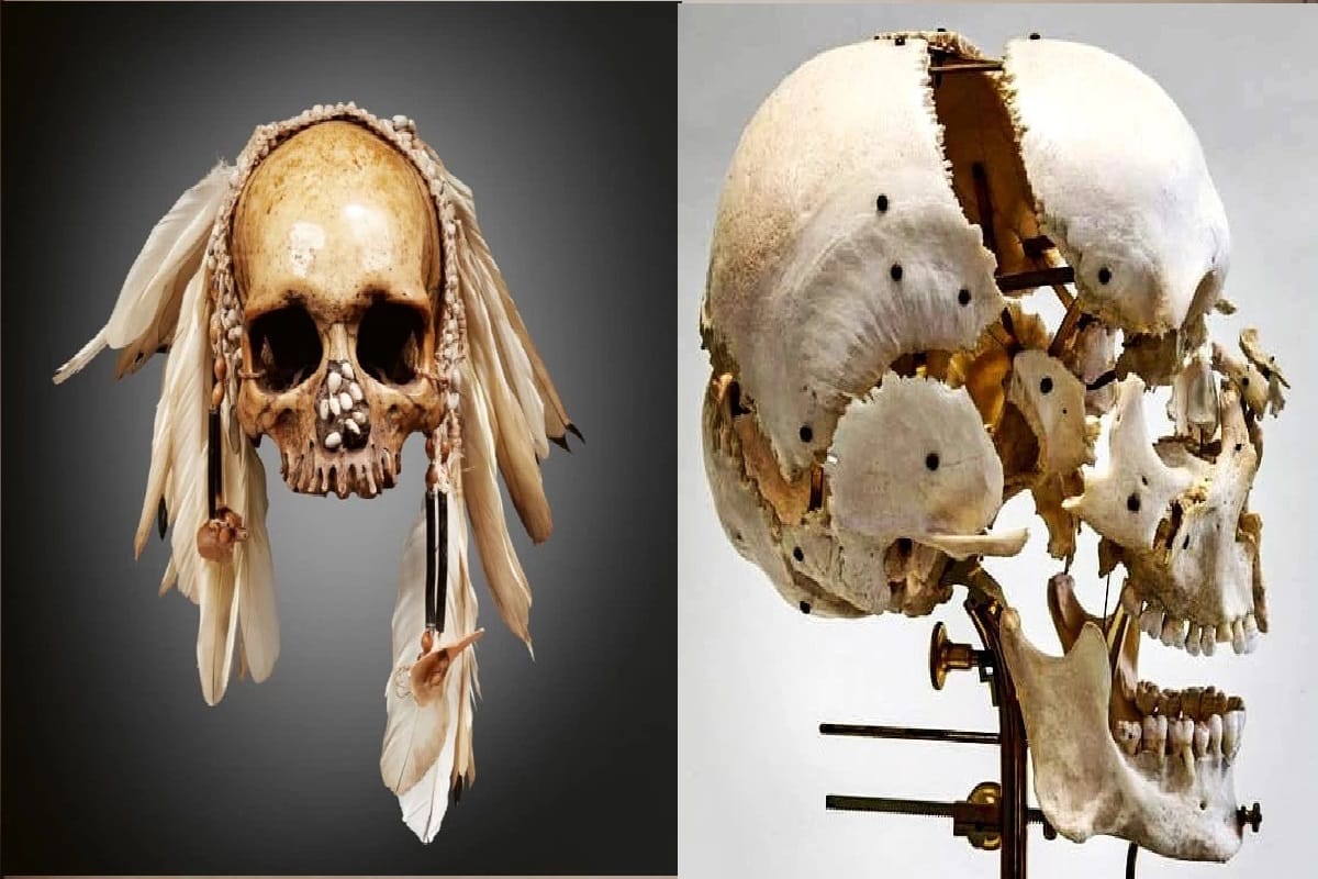 Human Skull