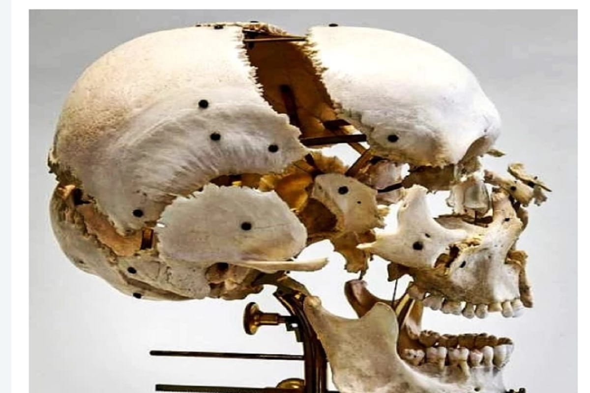 Human skull sold on Instagram in UK business worth of rupees 70 lakh