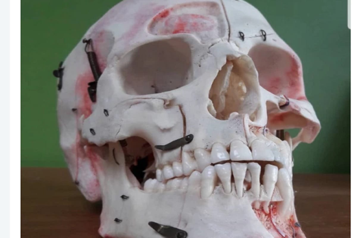 Human skull sold on Instagram in UK business worth of rupees 70 lakh