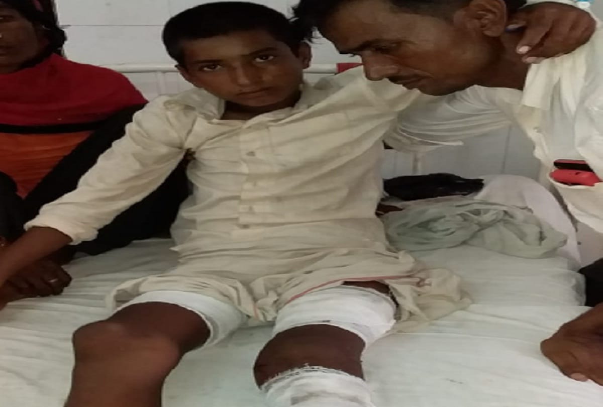 12 years boy injured by attack of crocodile, Bareilly, UP