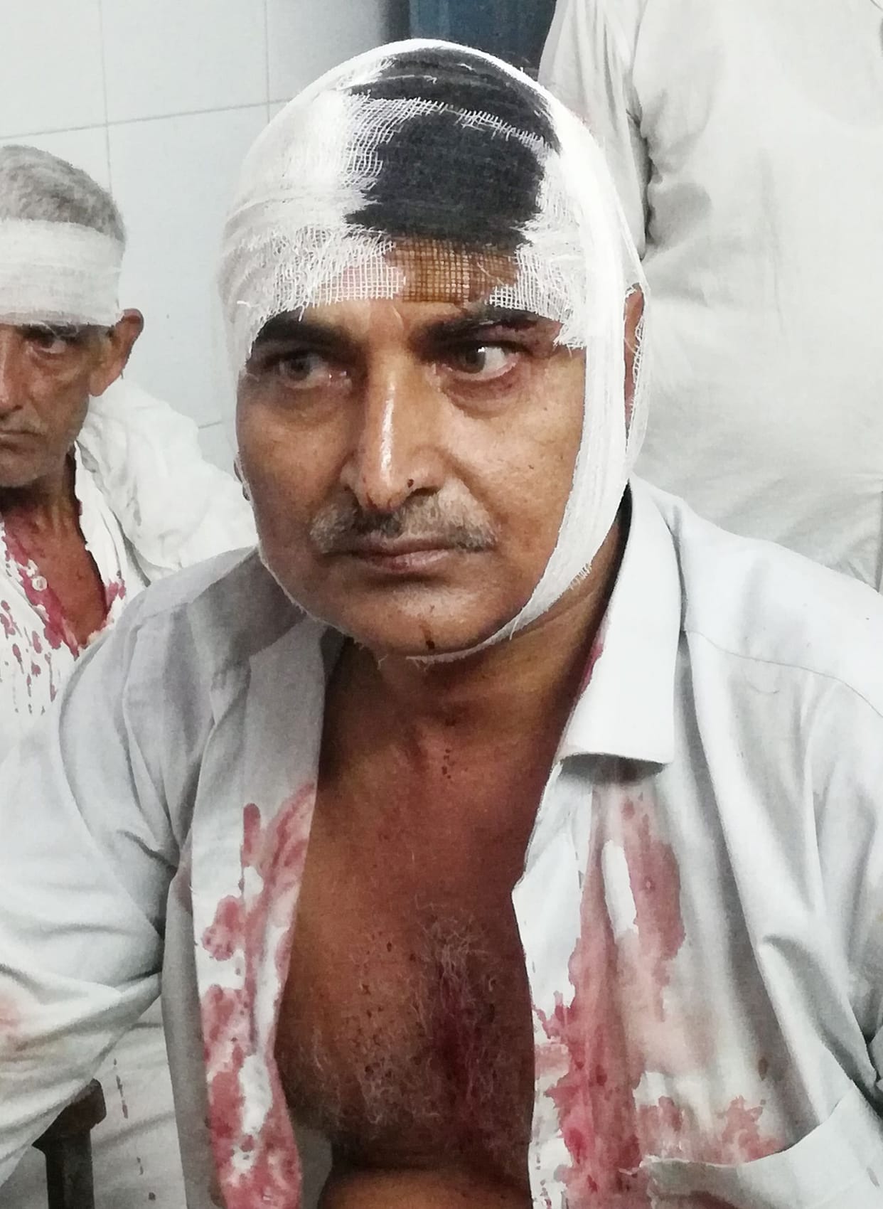 beating in rage, five injured