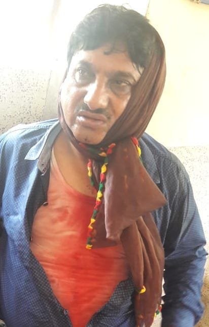 Brick and stone attack on the liquor businessman
