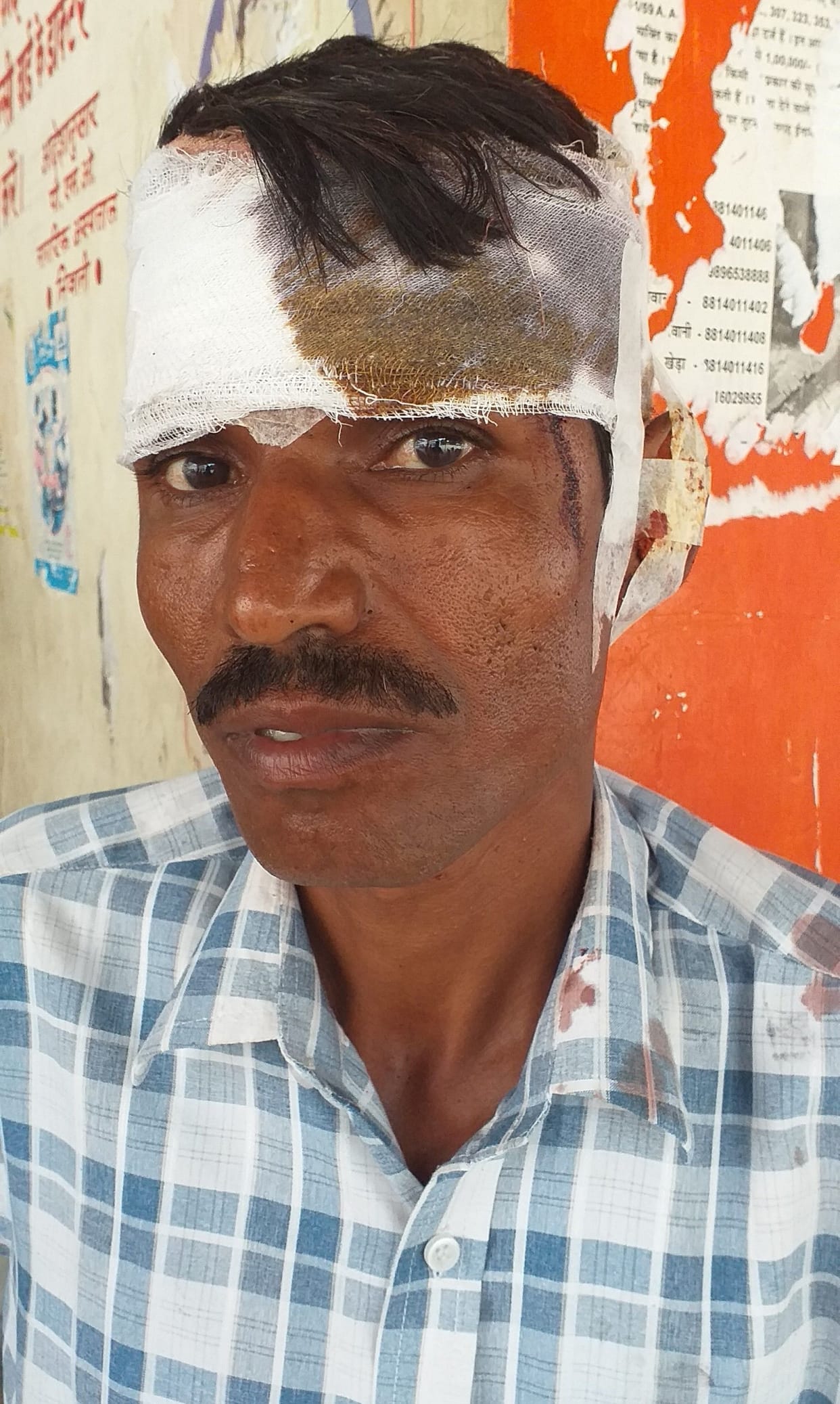 4 injured in the accident