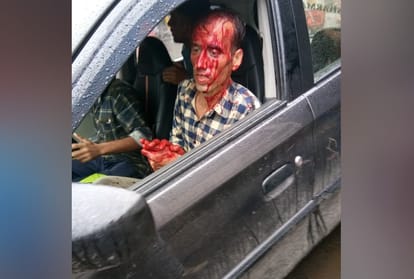 Leopard attack four injured in ronaht market shillai sirmaur himachal pradesh