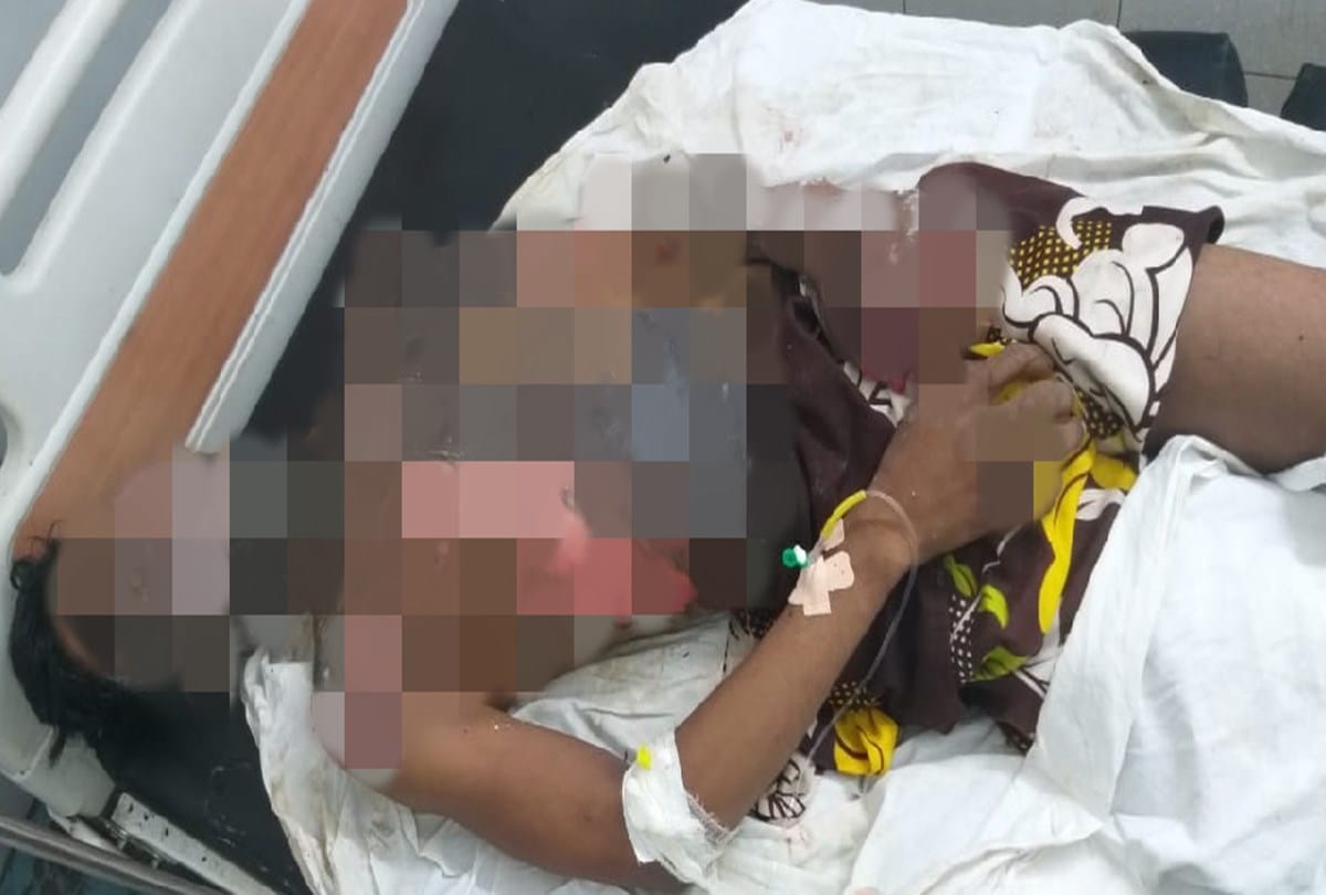 Victim chang the statement in case of burned alive in Varanasi UP