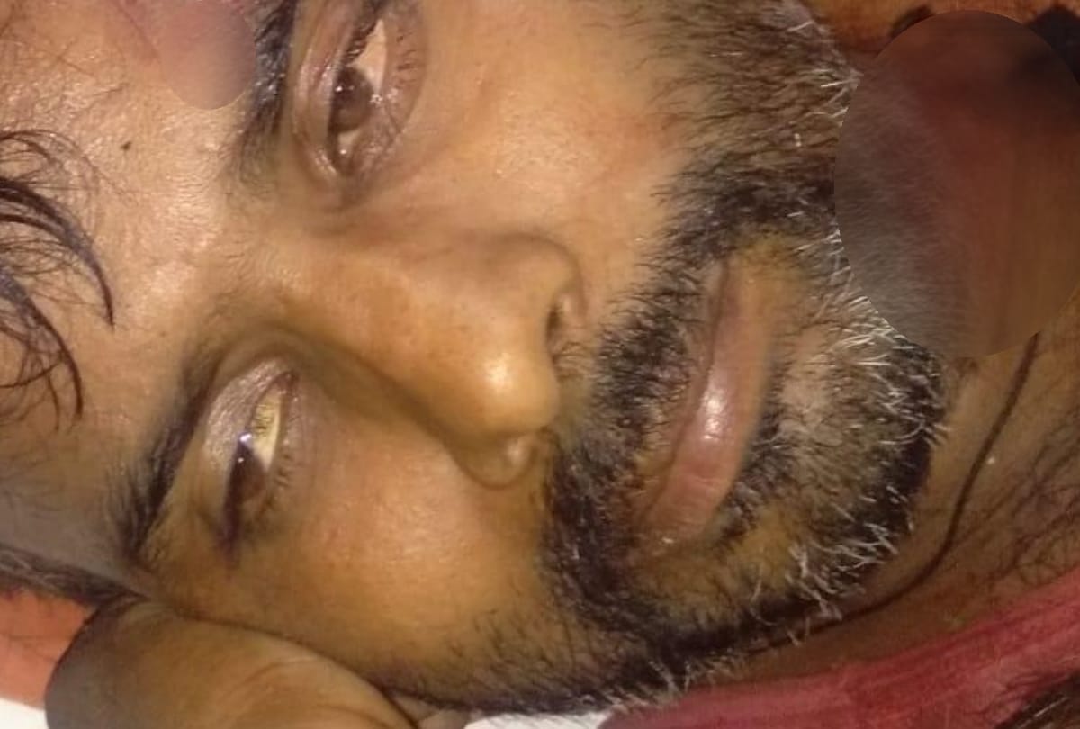 man fell down on gate, injured in lucknow