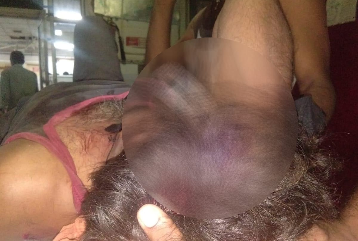 man fell down on gate, injured in lucknow