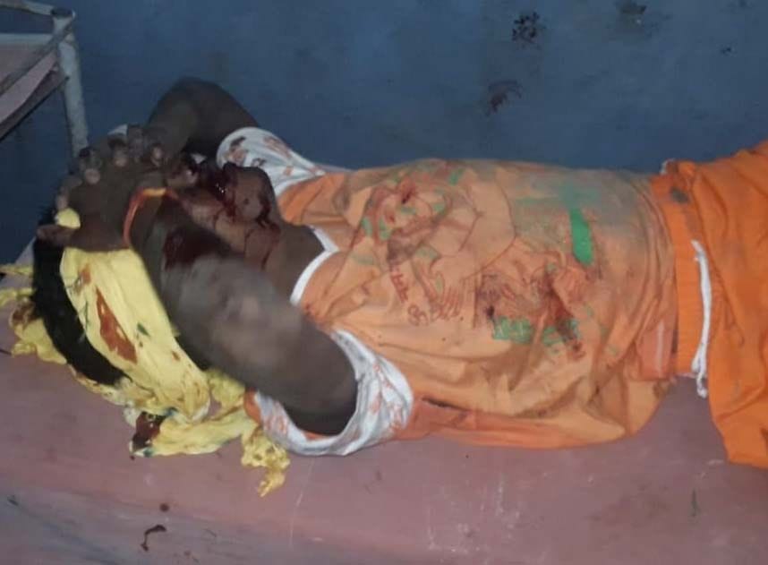 Many casualties injured in highway accident