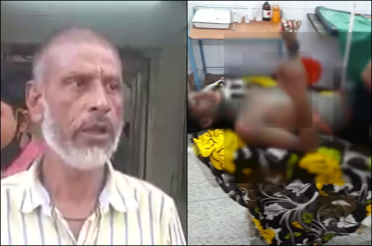 Chandauli Teen Burn To Sprinkled Kerosene Oil Case died In varanasi