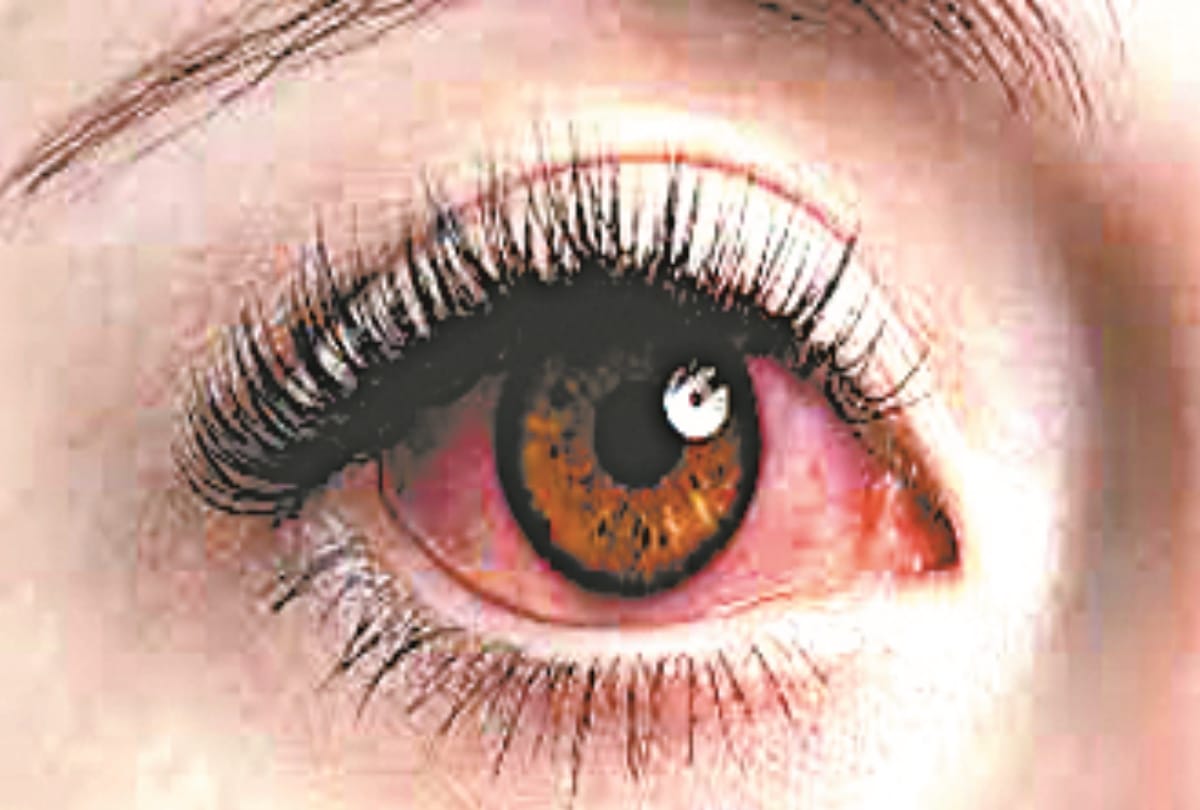 special care of eyes in rainy season