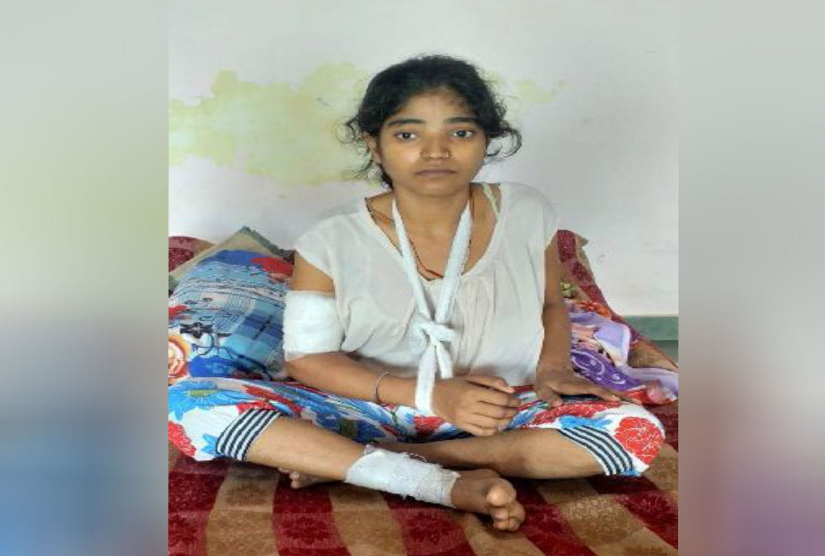 teenager injured in monkey attack at Vrindavan