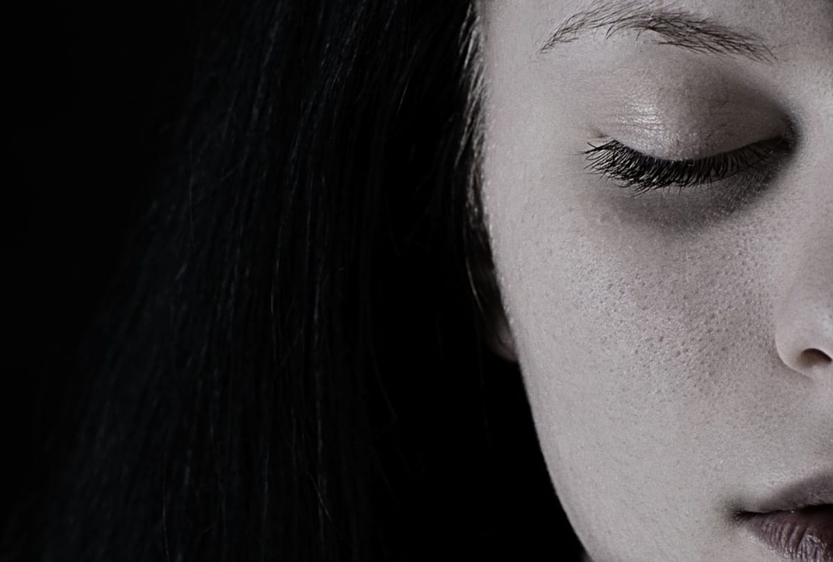 female above 30 age suffering from scleroderma skin disease with no treatment