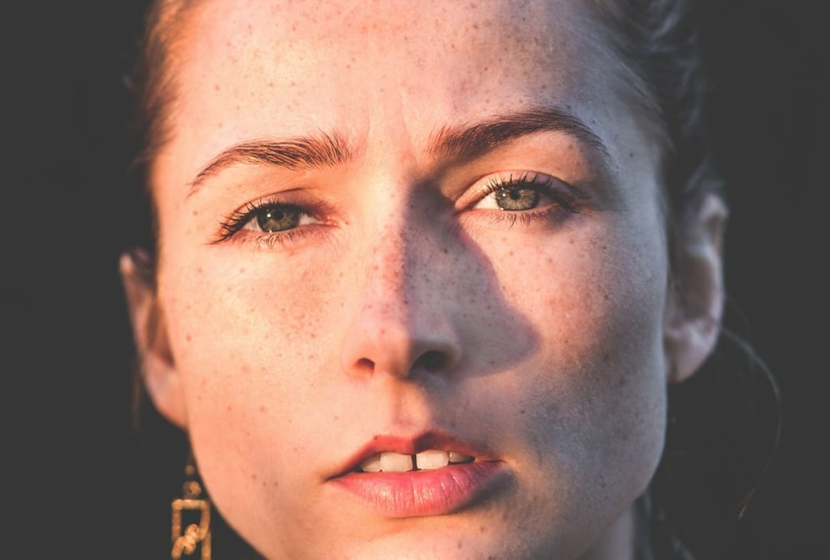 female above 30 age suffering from scleroderma skin disease with no treatment
