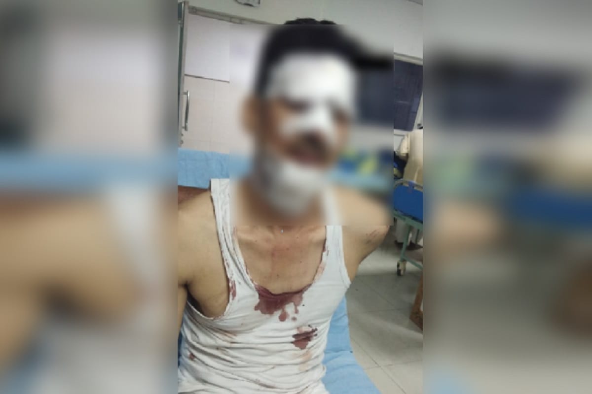 Sub inspector died and three soldiers injured in truck accident at Baghpat of UP