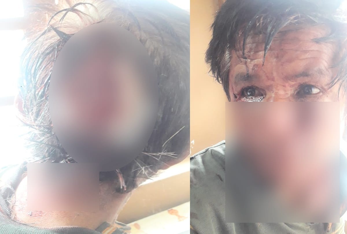 bear attacked pwd employee in jubbal shimla