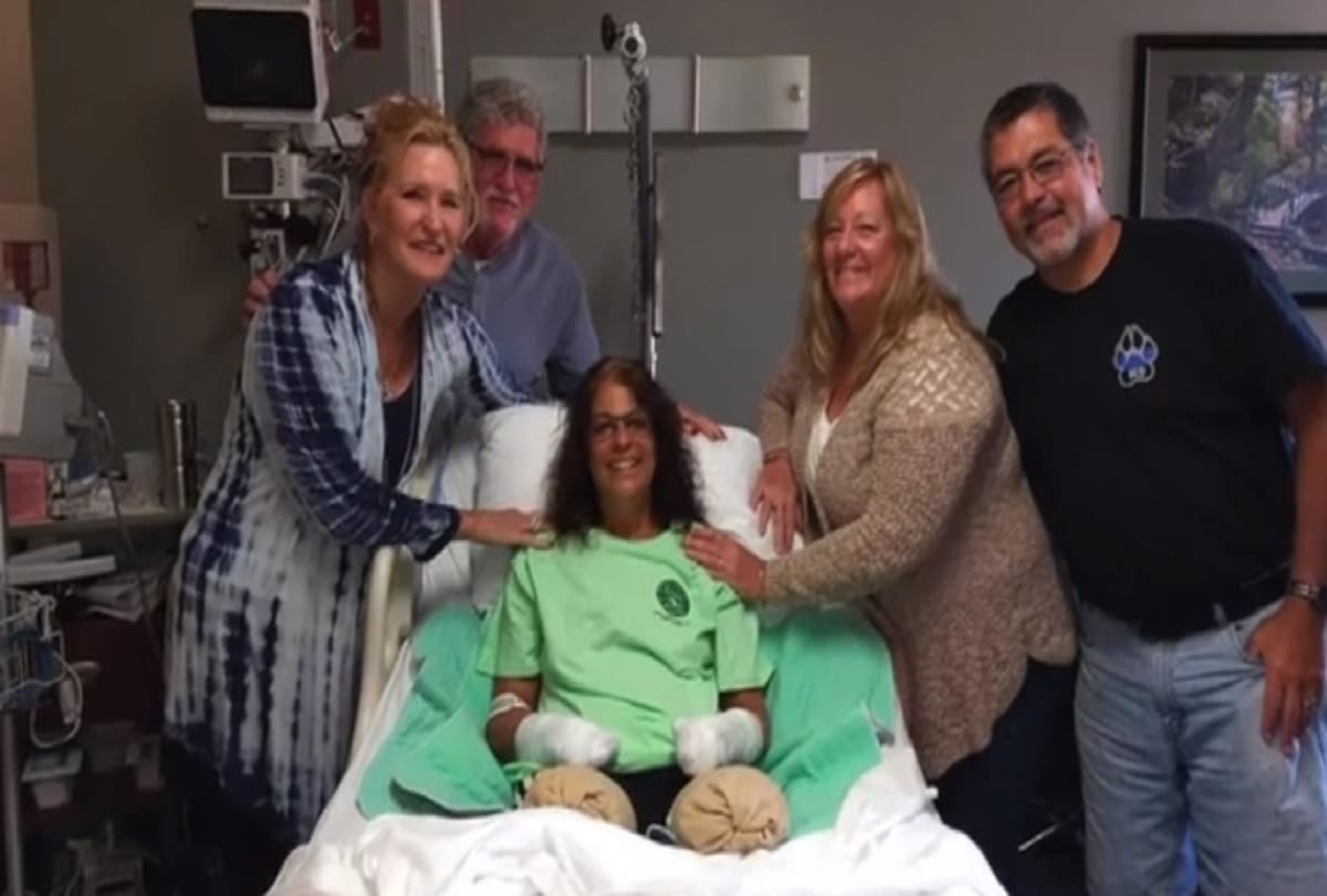 woman lost her hands and legs to an infection from dog kisses in Ohio USA
