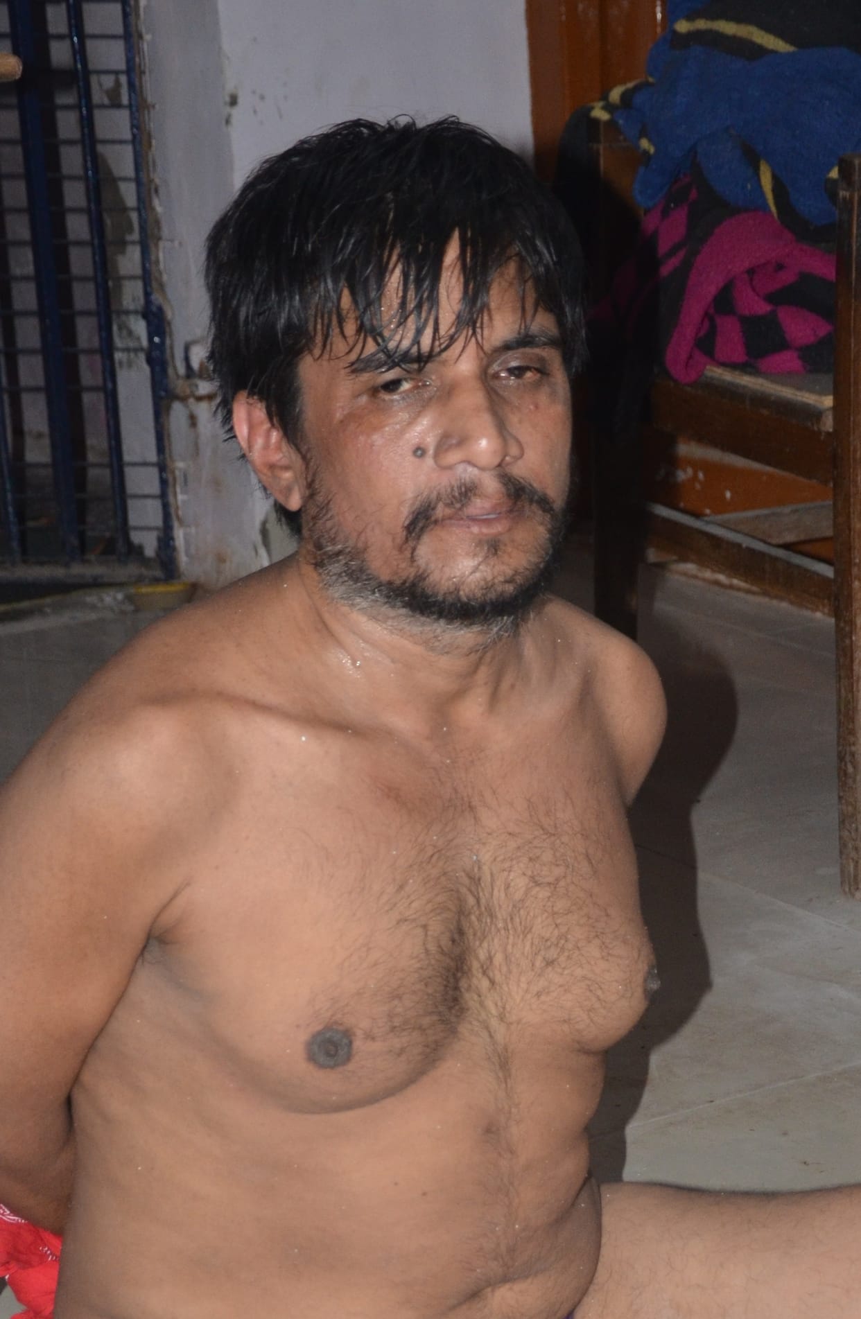 Brother wrote the case, accused of throwing acid in jail