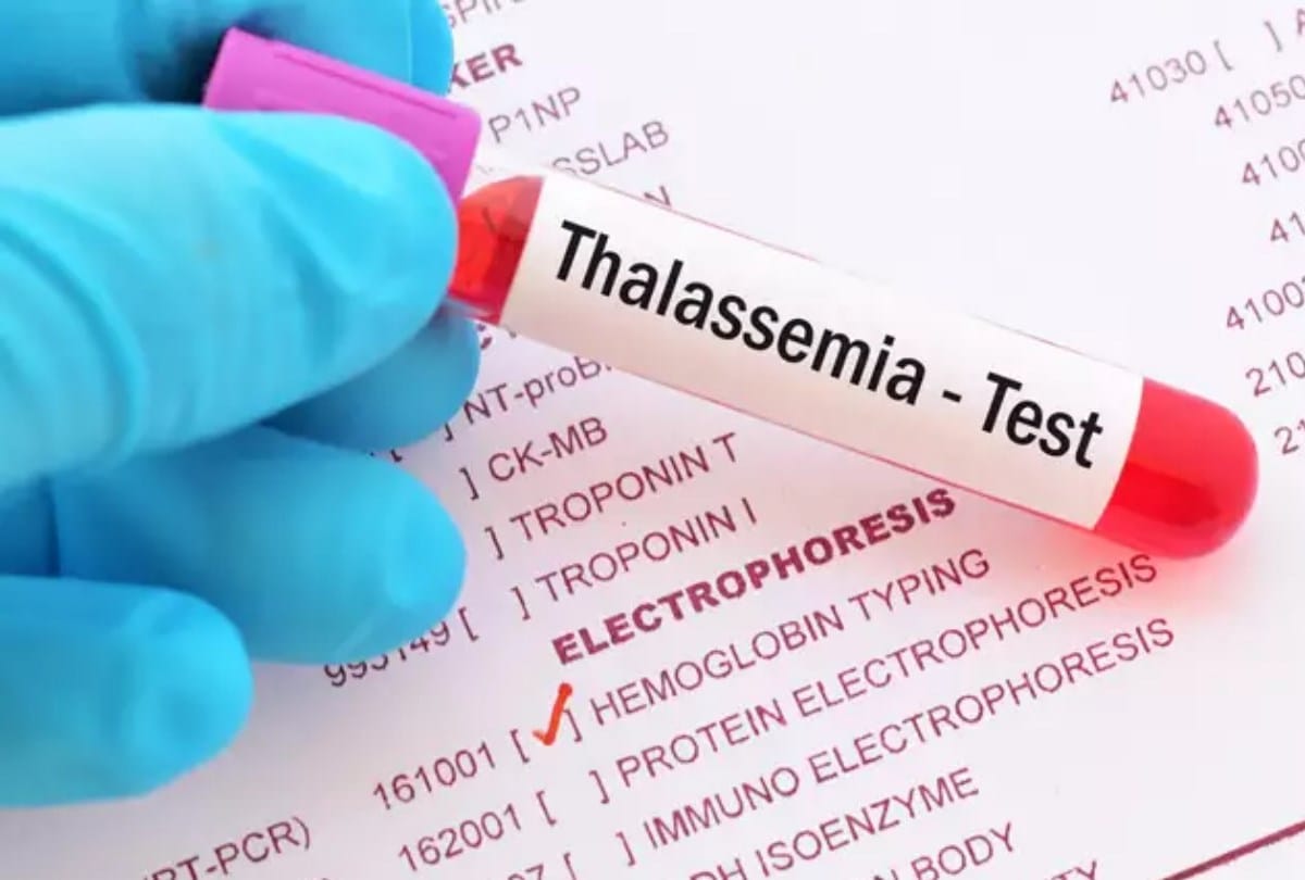 Thalassemia patients follow these rules to prevent corona infection