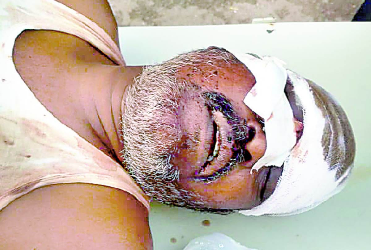 attack on couple, wife died and husband injured in lucknow