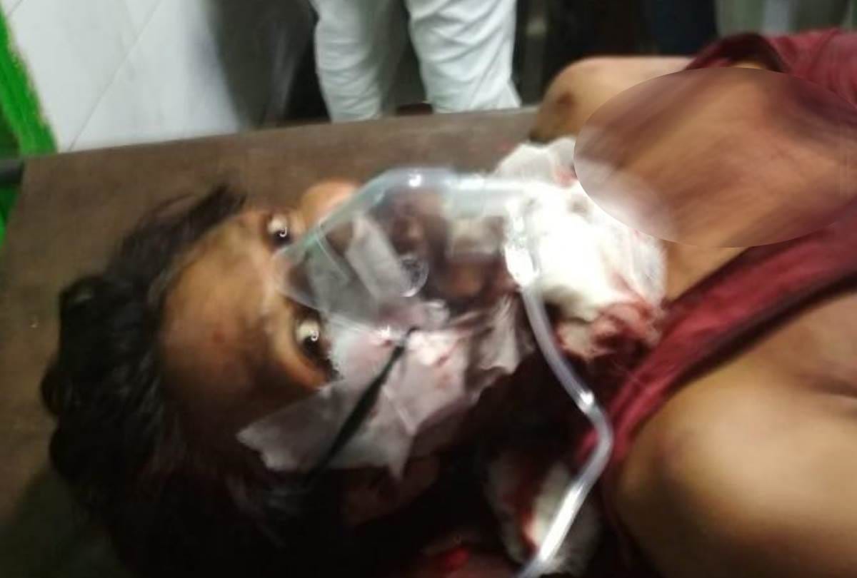 man attacked on his aunt with knife, died in lucknow