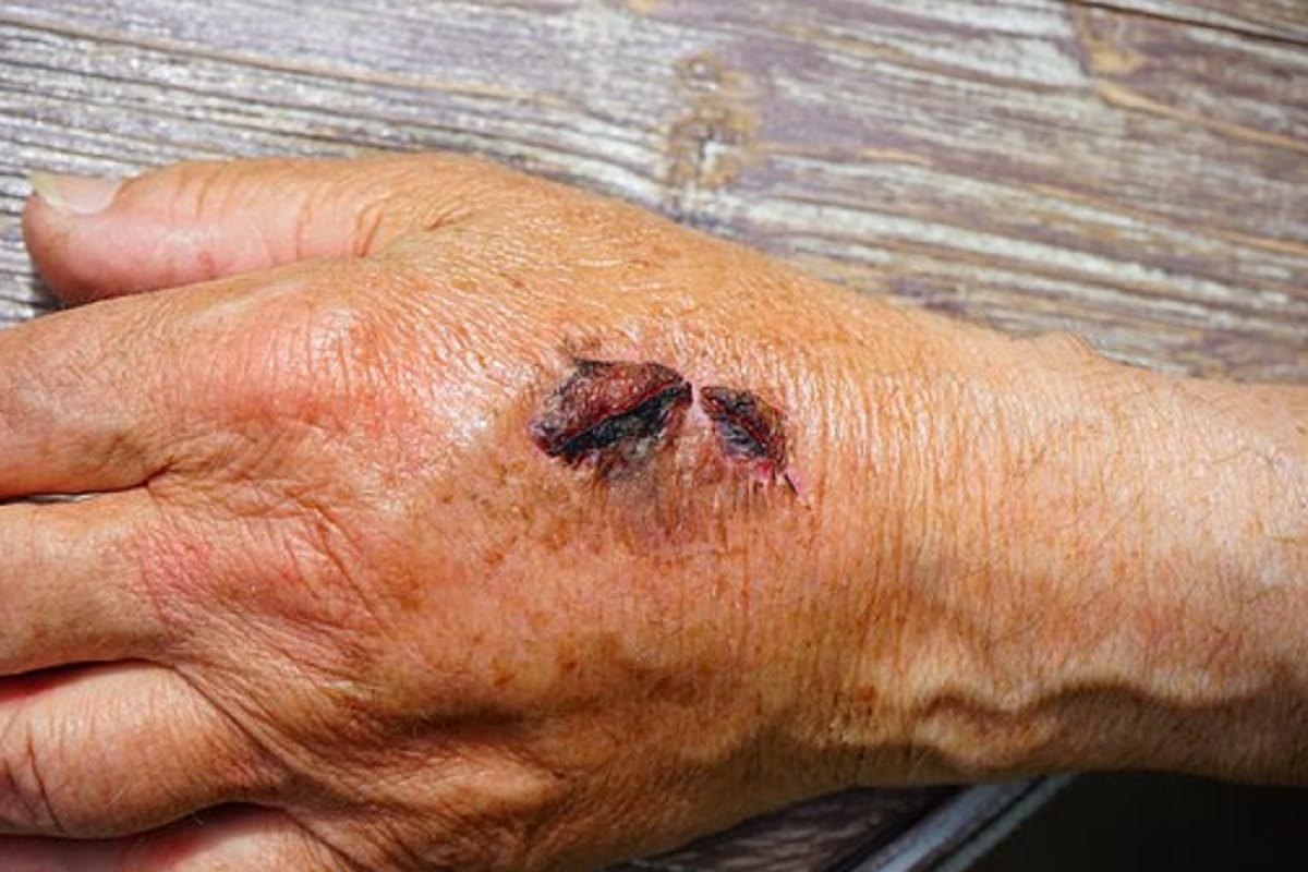 body gives you these 5 signs before you get cancer