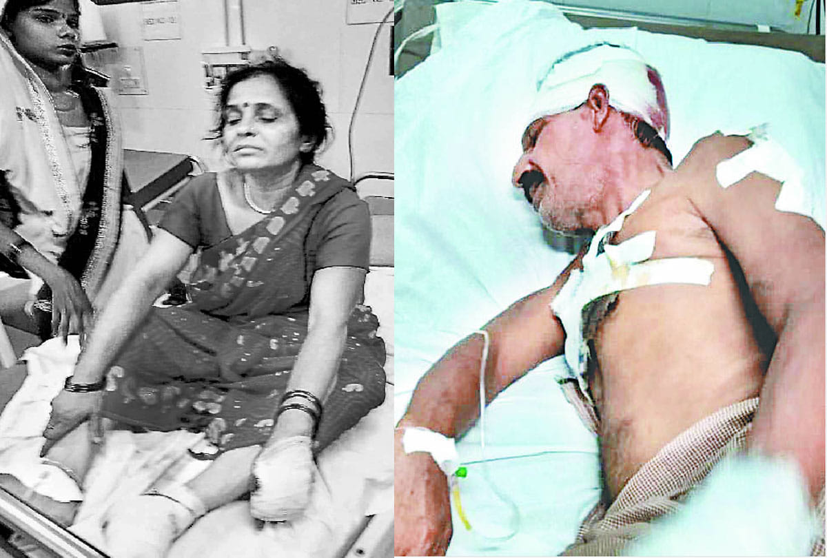 HT line breaks and fall on BJP lady leader and her husband scorched