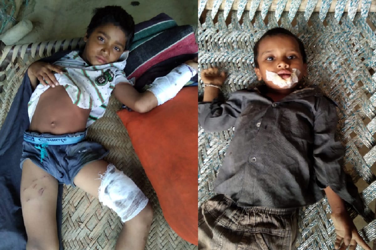 Dogs attacked on many child in deoband of Saharanpur district