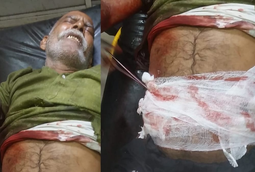 Two injured in firing in ayodhya.
