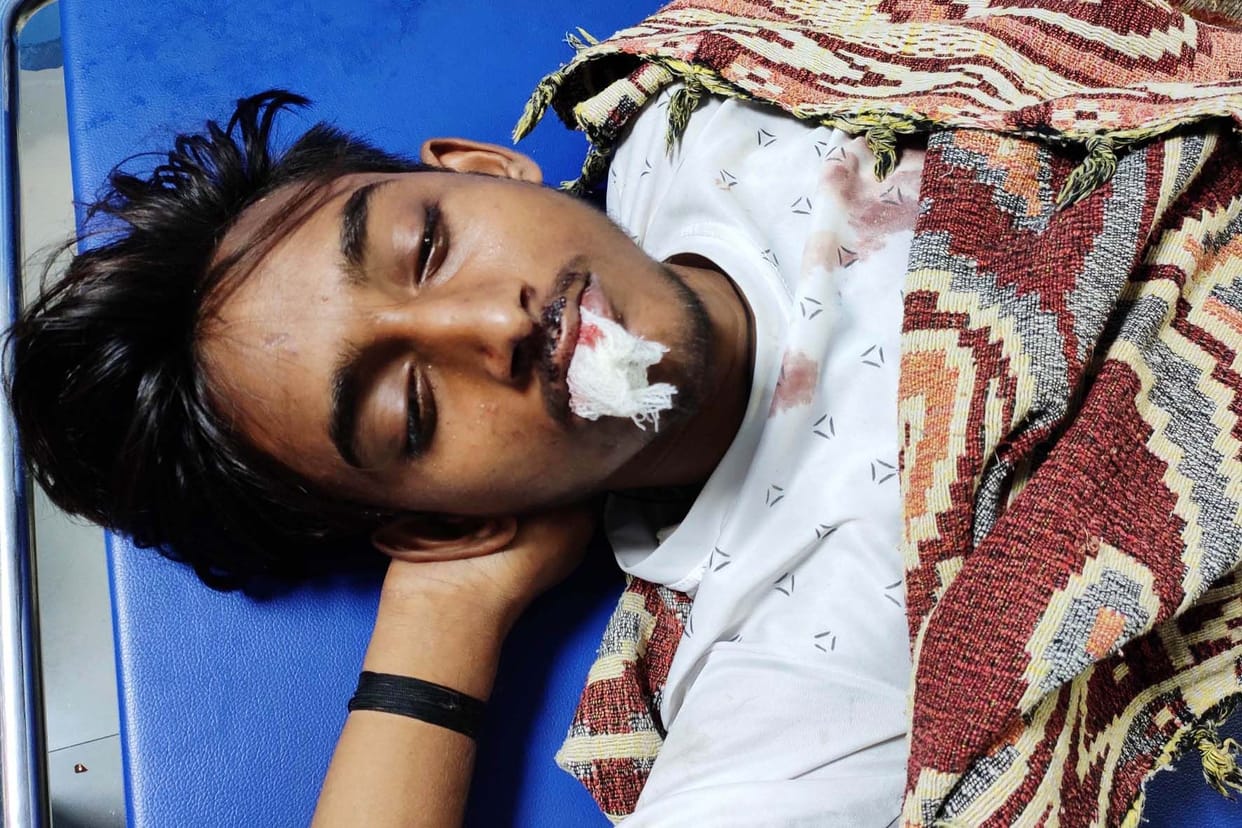 two brothers injured in accident.