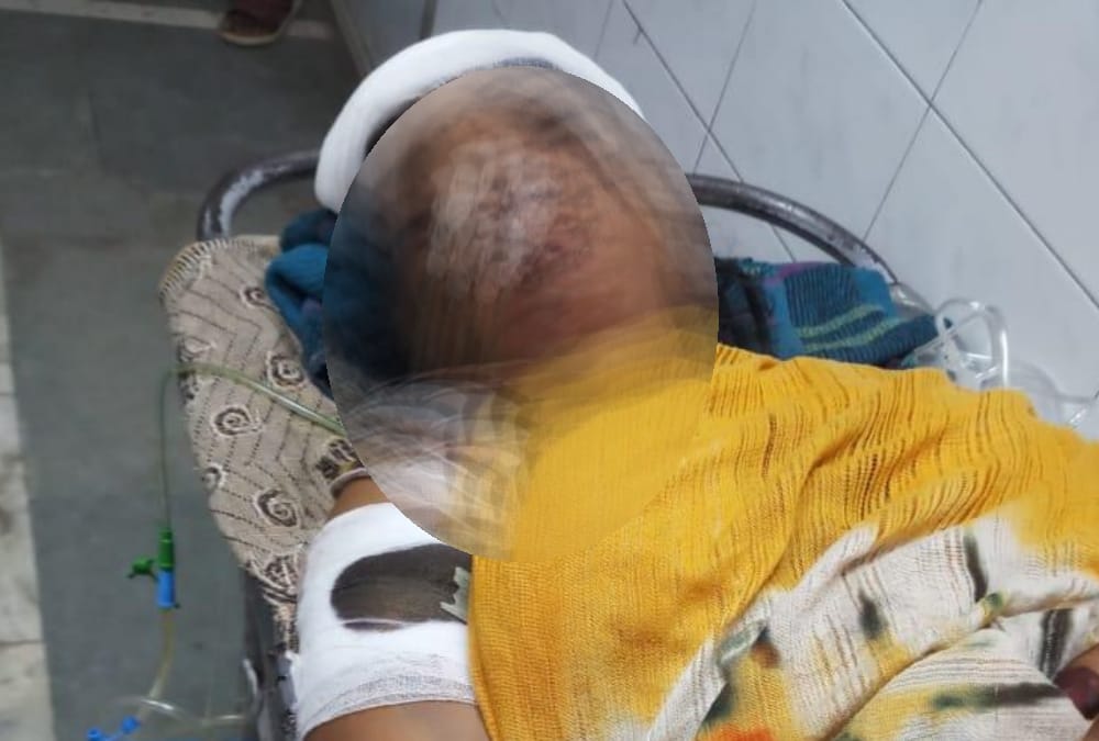 A child died in an accident in Sarojininagar in Lucknow.