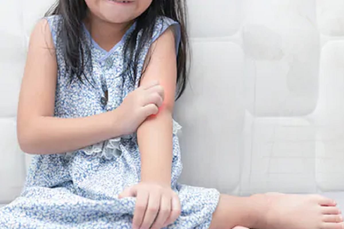 know how to affect allergy in your body and how to prevent it