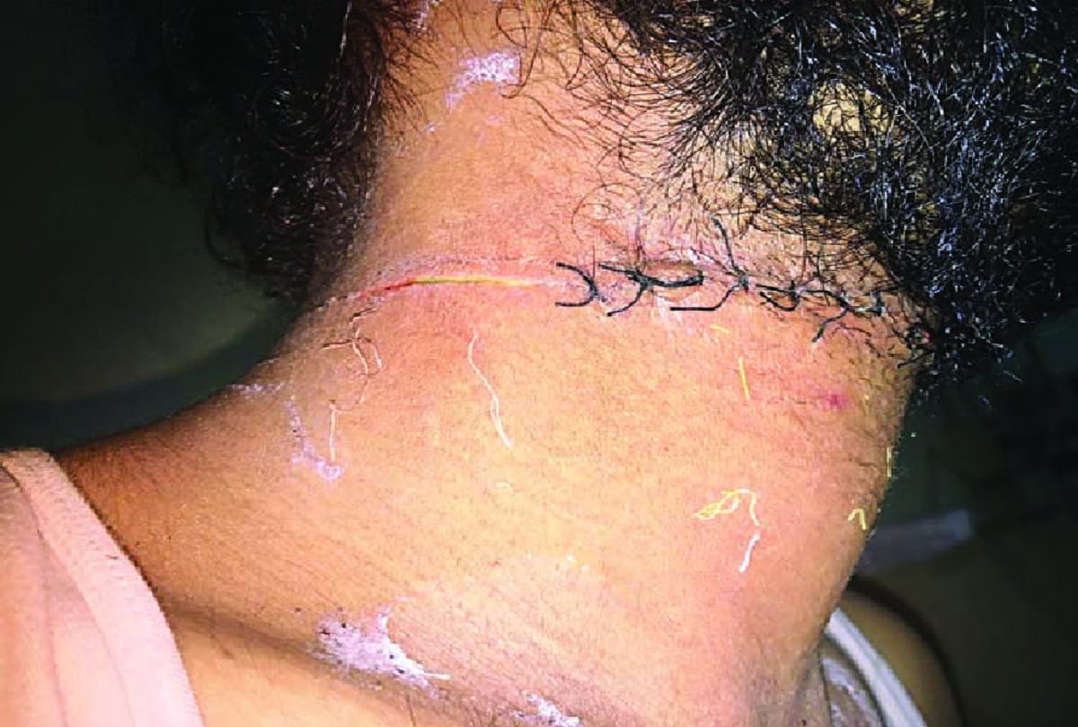 Another engineer neck cut due to Chinese manjha