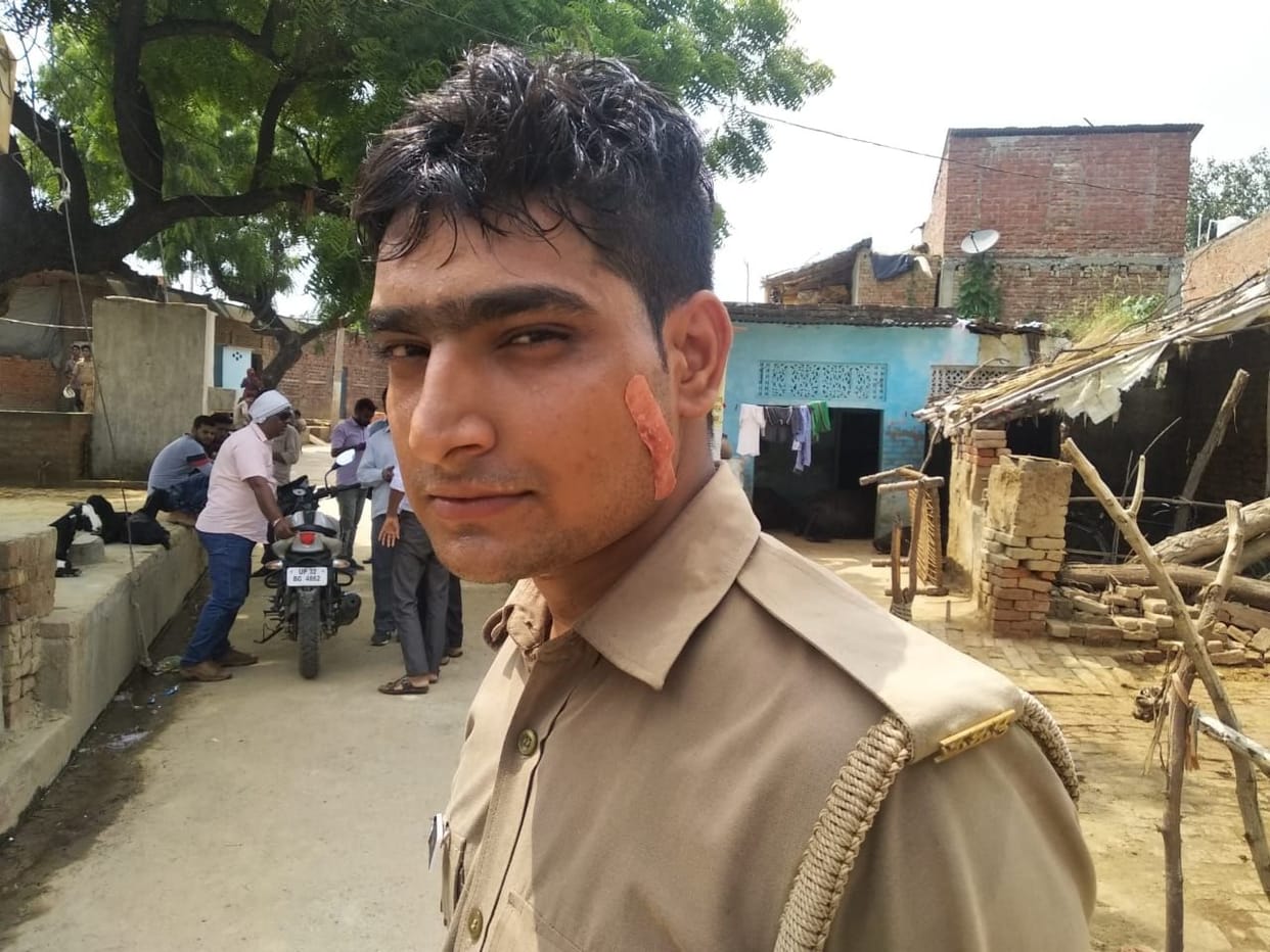 Conflict between women and police, four police personnel injured in stone pelting