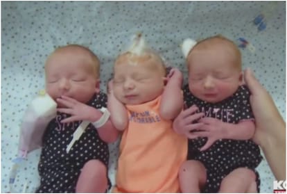 woman who thought she had kidney stones was actually pregnant with triplets