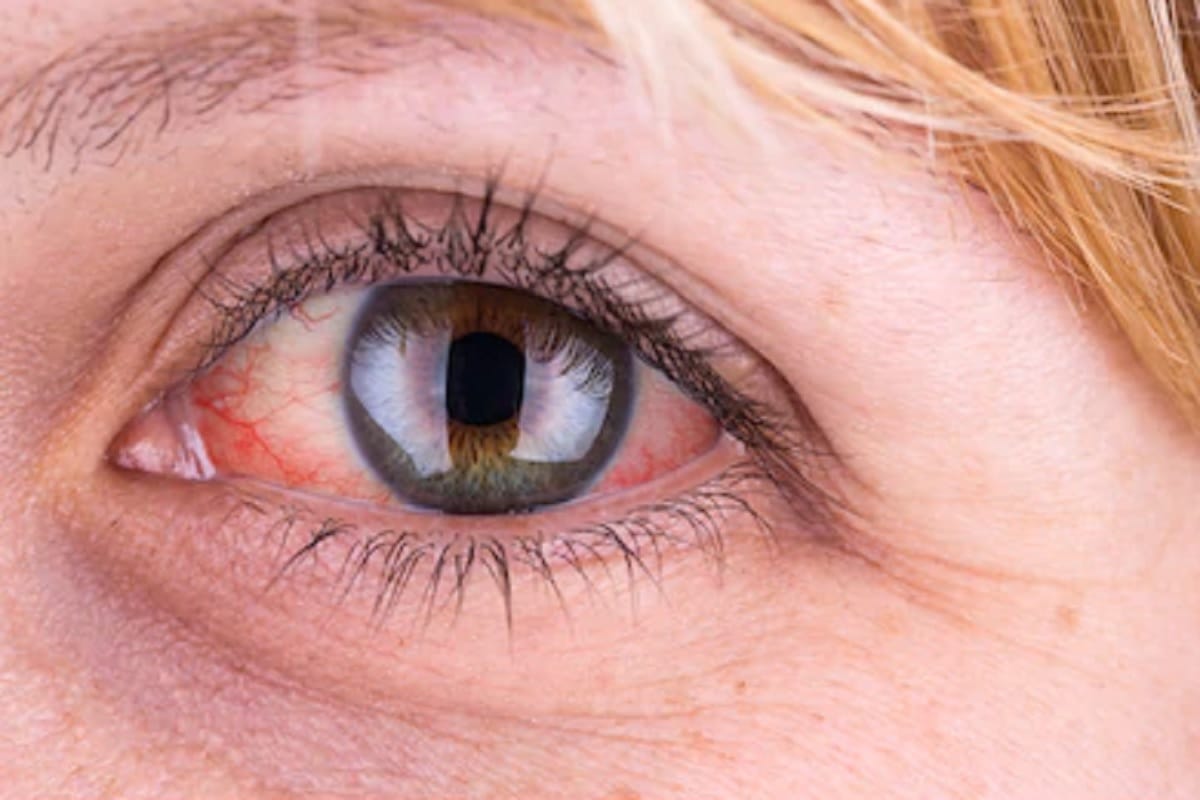 coronavirus myths information truth red eyes were your ears while going outside