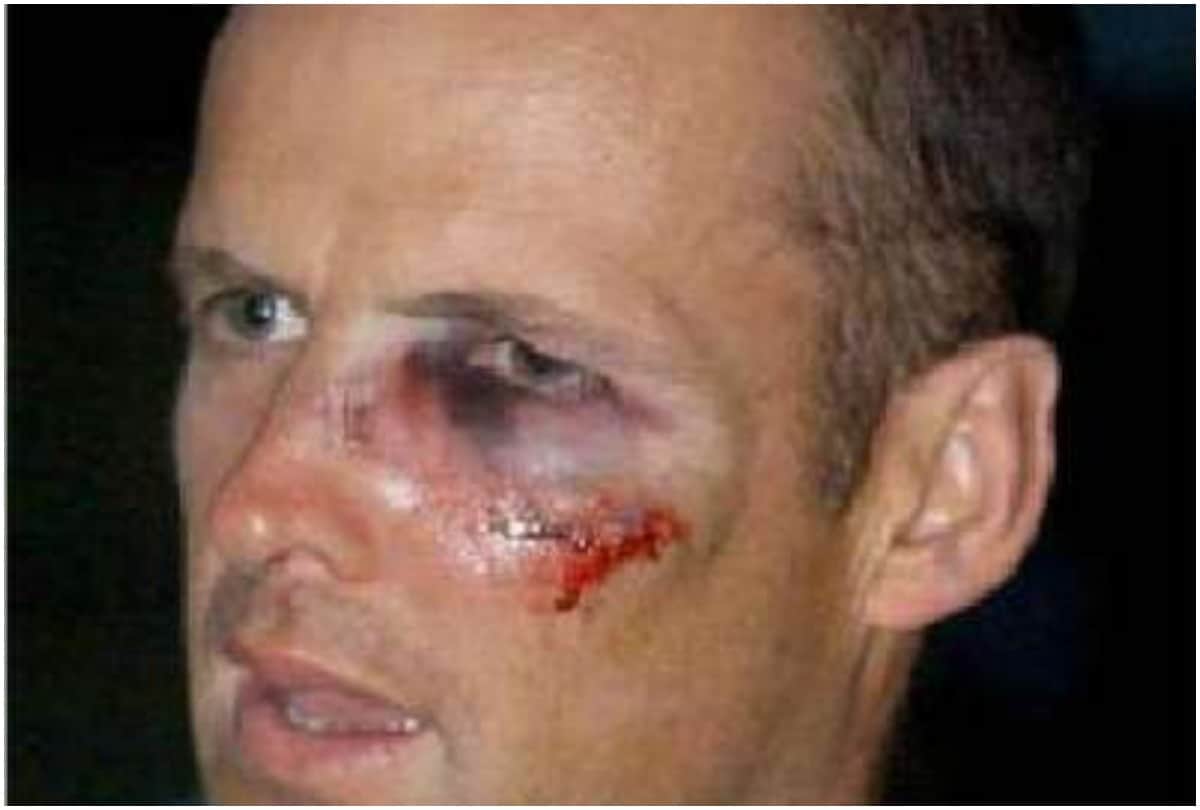 Phillip Hughes to saba karim Five Players who extremely injured on Cricket field