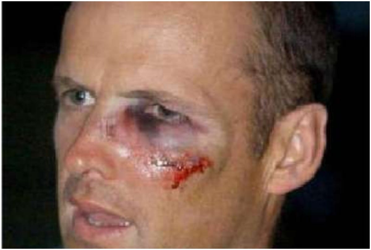 Phillip Hughes to saba karim Five Players who extremely injured on Cricket field