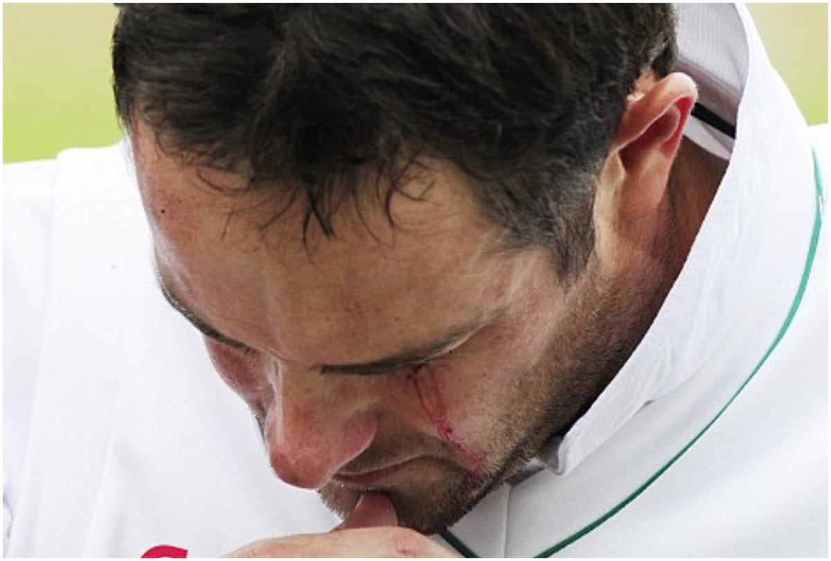 Phillip Hughes to saba karim Five Players who extremely injured on Cricket field