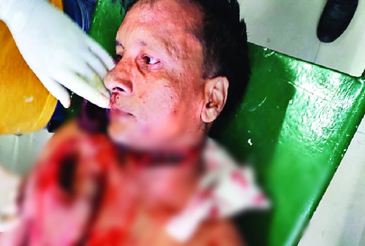 Man attacked with knife on father and mother over Job, Delhi