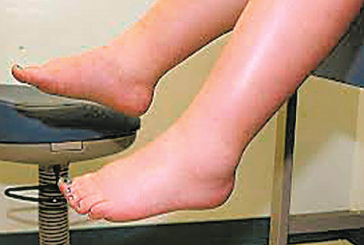 special care for pregnant ladies
