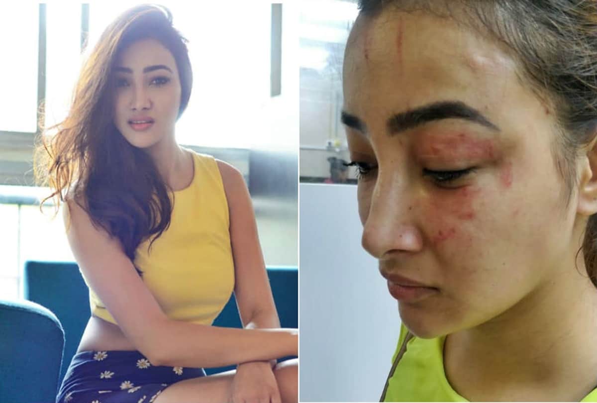 Splitsvilla and Naamkarann Fame Nalini Negi Accuses Her Roommate Preeti Rana Of Physical Assault