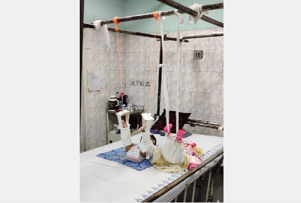 treatment of baby girl with help of doll in lok nayak hospital will study doctors